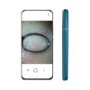 Wisdom APP WIFI Smart Visible Pore Ceansing 1.0 Megapixels Blackhead Remover Pore Cleaner 200mAh IPX6 Waterproof Portabl