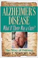 Alzheimer